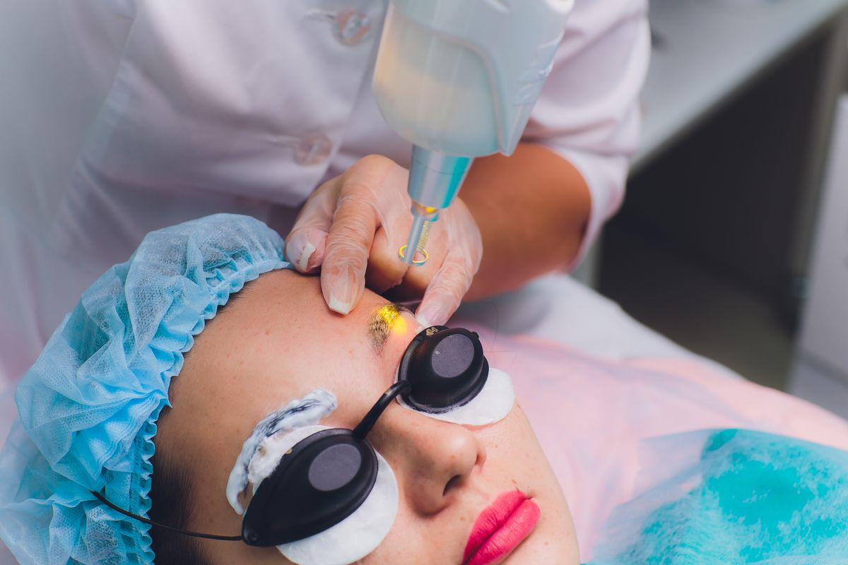 Eyebrow Tattoo Removal