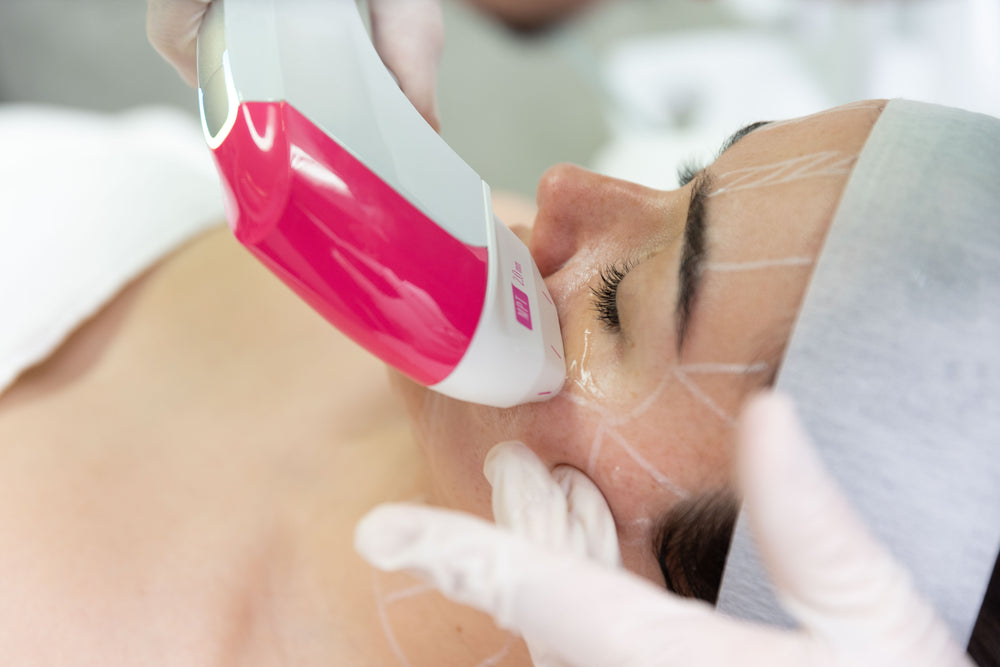 Eyebrow Tattoo Removal